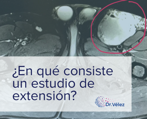 estudio de extensión _ DR Roberto Vélez