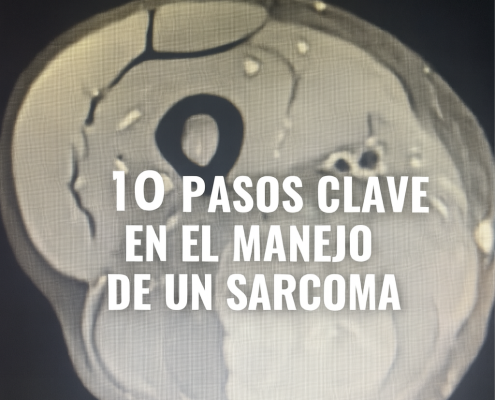 Manejo de un sarcoma de partes blandas